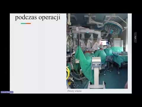 Opinie pacjentów na temat przeprowadzenia operacji z użyciem robota Da Vinci